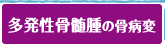 多発生骨髄腫の骨病変