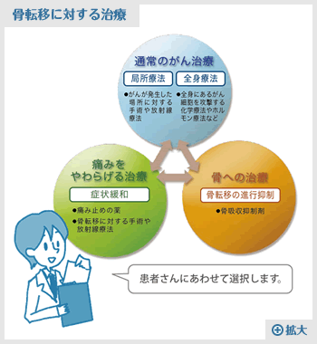 骨転移に対する治療